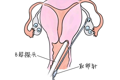 http://nantong.vdtfzz.com/post/205.html|南通供卵助孕